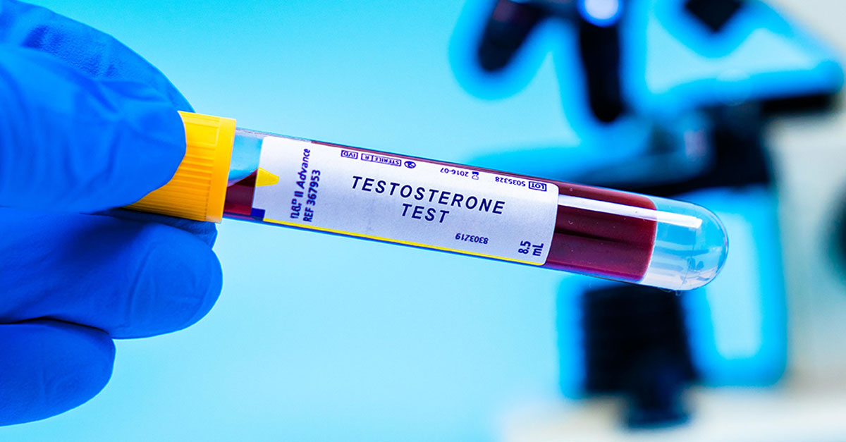 Testosterone Testing Hampshire